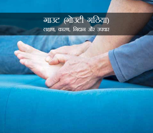 Gout in Hindi Gout in Hindi