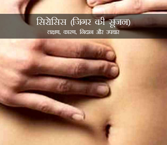 Cirrhosis in Hindi Cirrhosis in Hindi