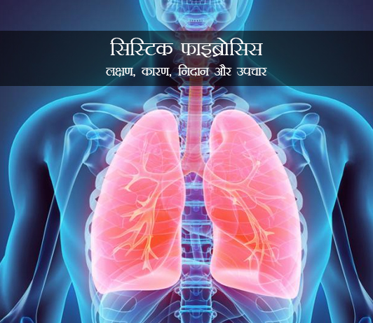 Cystic Fibrosis in Hindi Cystic Fibrosis in Hindi