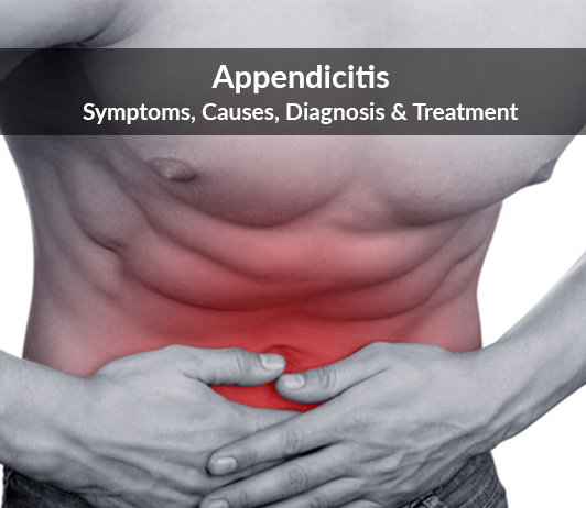 Symptoms appendicitis Signs and