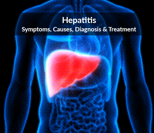 Hepatitis- Symptoms, Causes, Diagnosis & Treatment Hepatitis: Symptoms, Causes, Diagnosis & Treatment