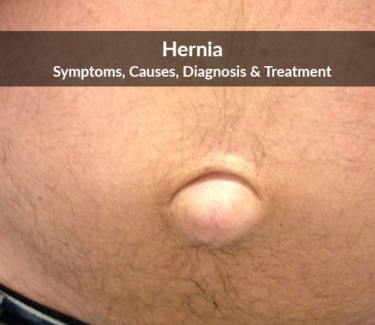 is a hernia painful