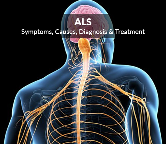 ALS (Amyotrophic Lateral Sclerosis)- Symptoms, Causes, Diagnosis & Treatment Lou Gehrig’s Disease (Amyotrophic Lateral Sclerosis, ALS): Symptoms, Causes, Diagnosis & Treatment