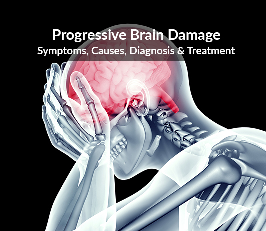 Progressive brain damage (Parkinson's disease) Progressive brain damage (Parkinson's disease) : Symptoms, Causes, Diagnosis & Treatment