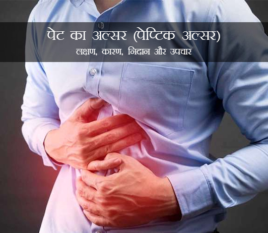 stomach-ulcer-peptic-ulcer-in-hindi stomach-ulcer-peptic-ulcer-in-hindi