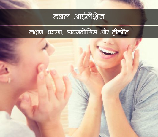 5 Distichiasis in Hindi - डबल आईलैशेज (डिस्टिचियासिस): लक्षण, कारण, डायगनोसिस और ट्रीटमेंट