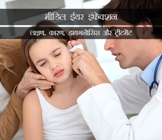 5 Middle Ear Infection (Otitis Media) in Hindi मीडिल ईयर इंफेक्शन (ओटिटिस मीडिया): लक्षण, कारण, डायगनोसिस और ट्रीटमेंट