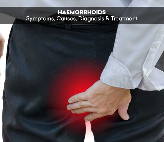 2 Haemorrhoids: Symptoms, Causes, Diagnosis & Treatment