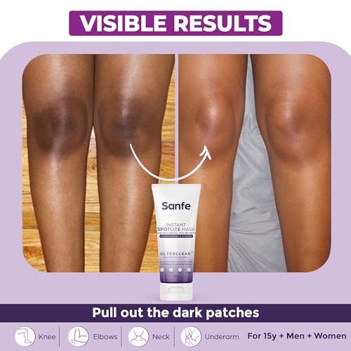 Sanfe Instant Spotlite Mask For Dark Underrams, Neck & Body, Dark Patch Removal
