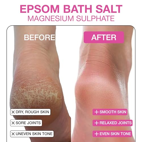 Soulflower Epsom Salt Crystal For Bath, Body Detox, Aura, Swelling & Soreness (Pack Of 1)